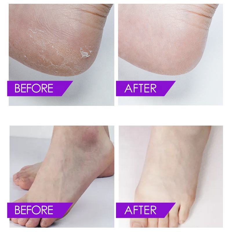 Lavender Crystal Jelly Spa Pedicure – Circulation & Anti-Swelling Foot Soak