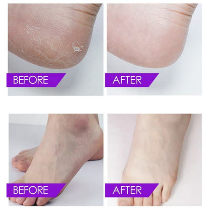 Lavender Crystal Jelly Spa Pedicure – Circulation & Anti-Swelling Foot Soak