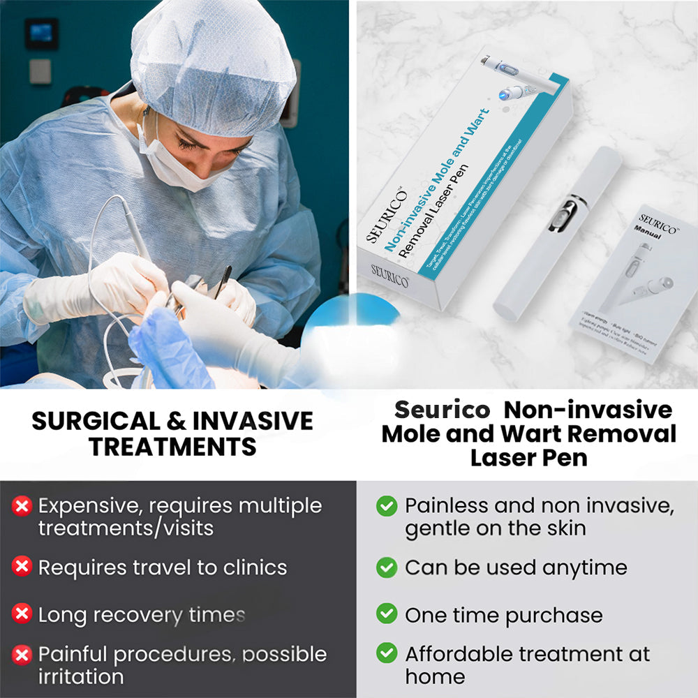 ✨Seurico™ Laser Pen - Non-invasive Mole and Wart Removal