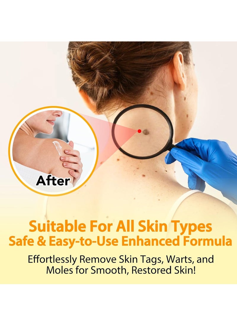 Tags & Moles Remover