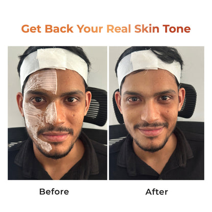 Niconi Tan Vanish Gluta-Kojic Skin Polish | Reduces Tan in 20 Mins | pH Balanced | 180g