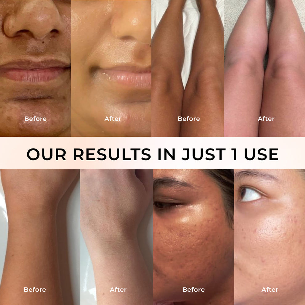 Niconi Tan Vanish Gluta-Kojic Skin Polish | Reduces Tan in 20 Mins | pH Balanced | 180g